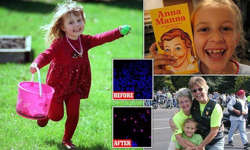 Anna Cancer