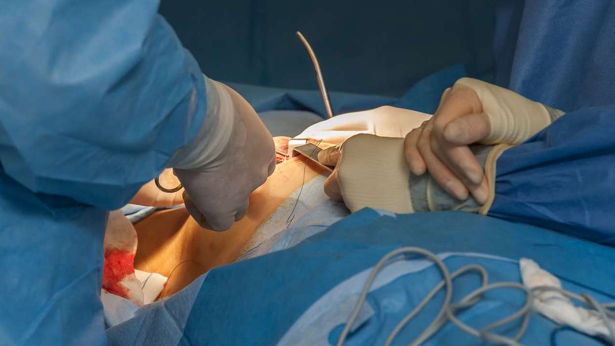 After 20 women underwent unnecessary mastectomies, why is surgeon Amir Bhatti still on full pay?