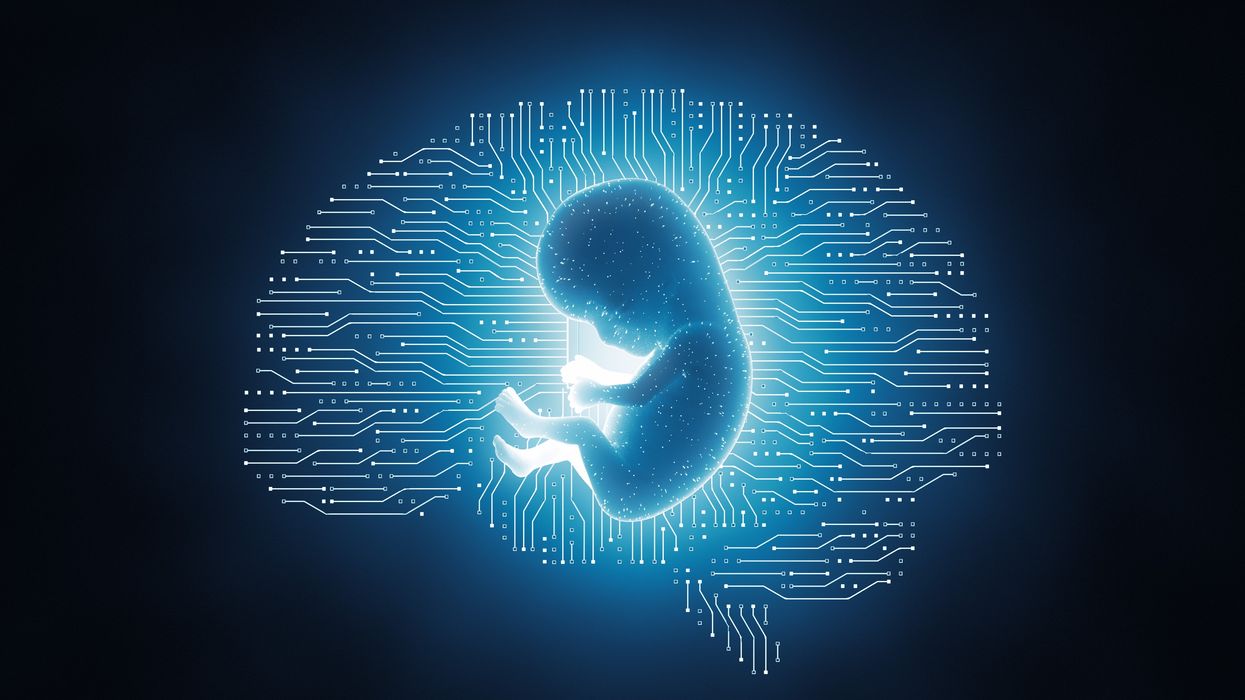 brain-structures-at-birth-getty