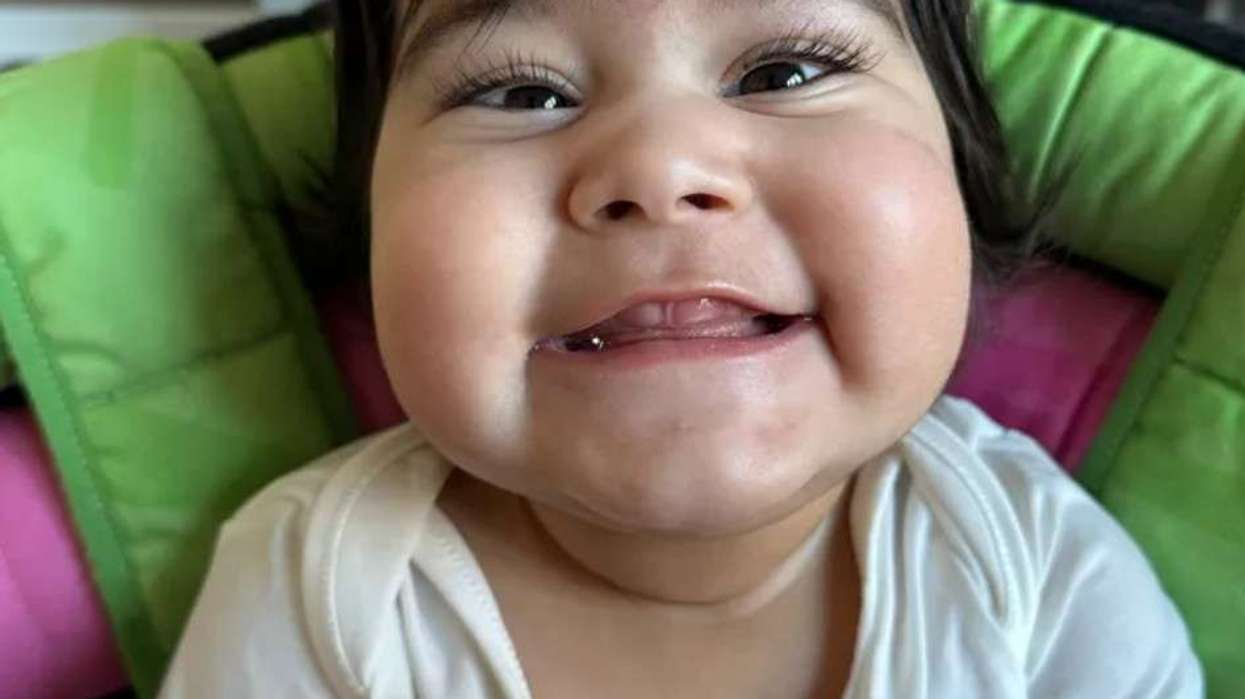Asian family seeks funds for toddler with ultra-rare genetic condition