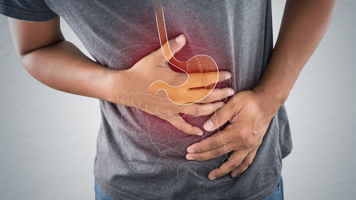Gastrointestinal issues are already known to be common among patients with neurodegenerative disorders, the study's authors said. (Representational image: iStock)