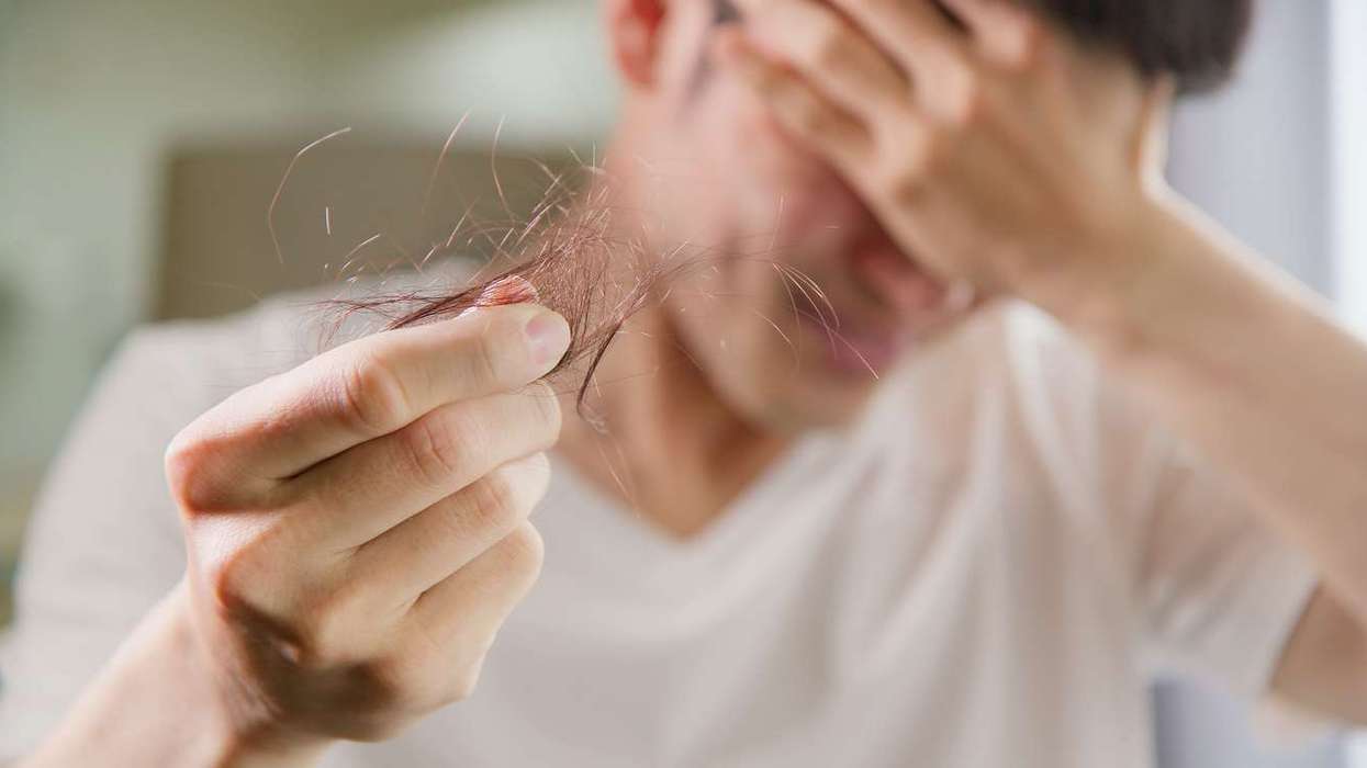 Hair Loss risks