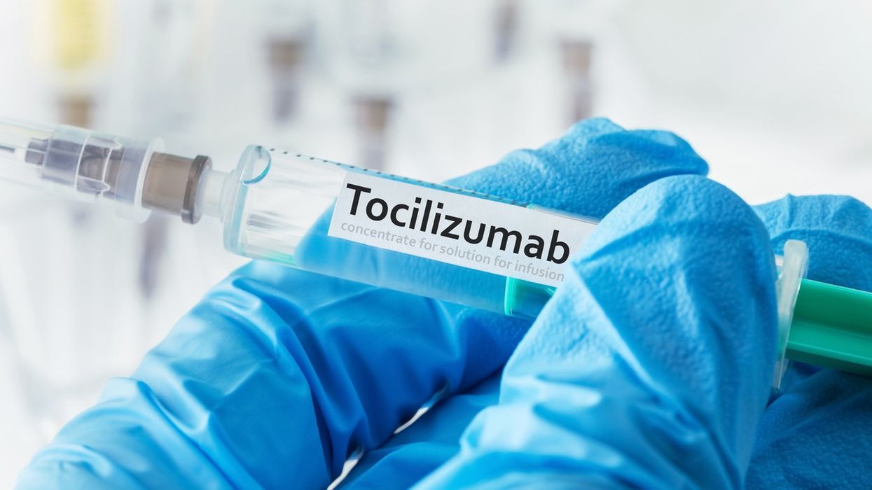 Arthritis drug Tocilizumab reduces severe Covid mortality: study