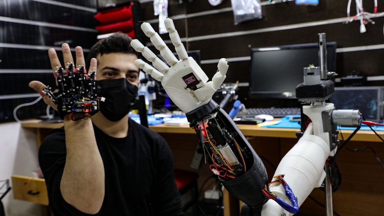 To Automate or Not to Automate 10 Things to Consider