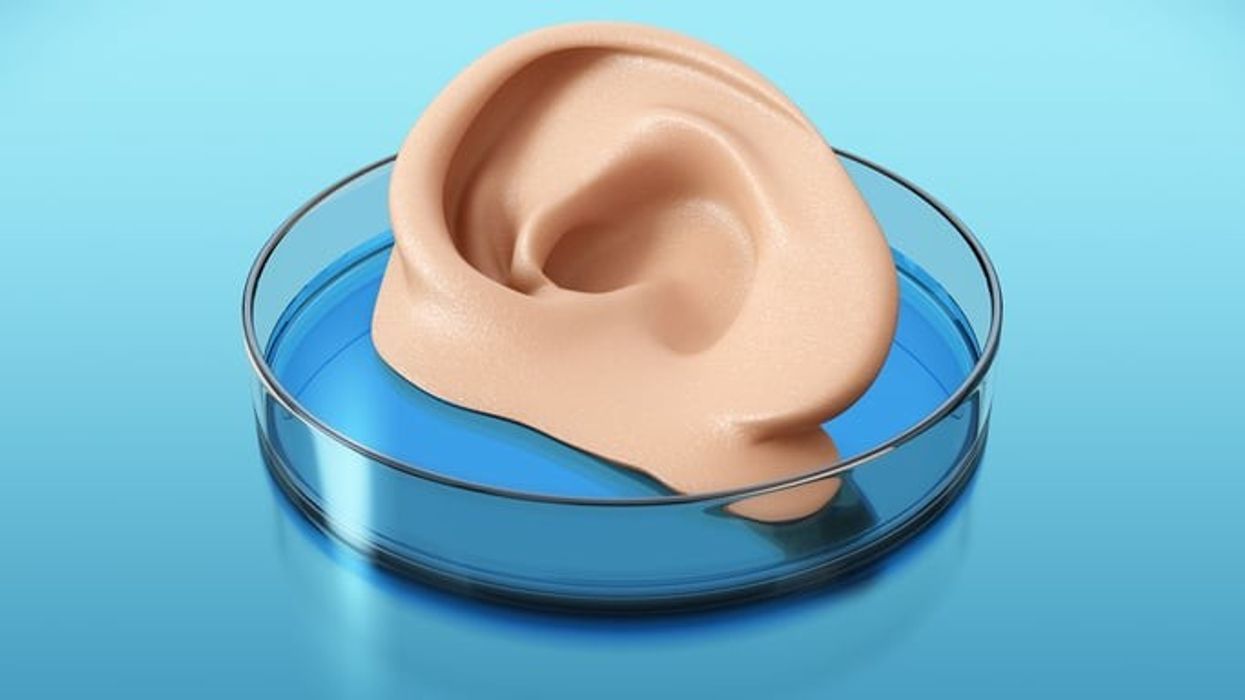 Girl, 10, set to become first person in UK to get 3D bioprinted ear