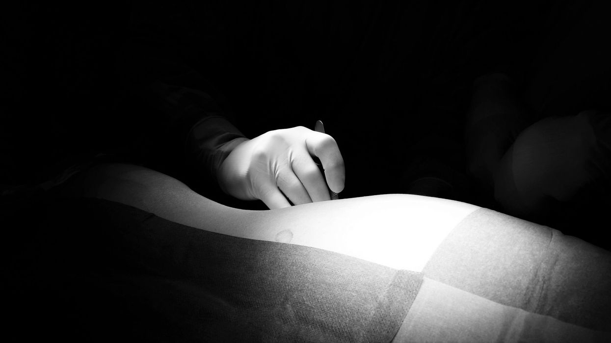 Asian and black patients 'less likely to have successful kidney transplants'