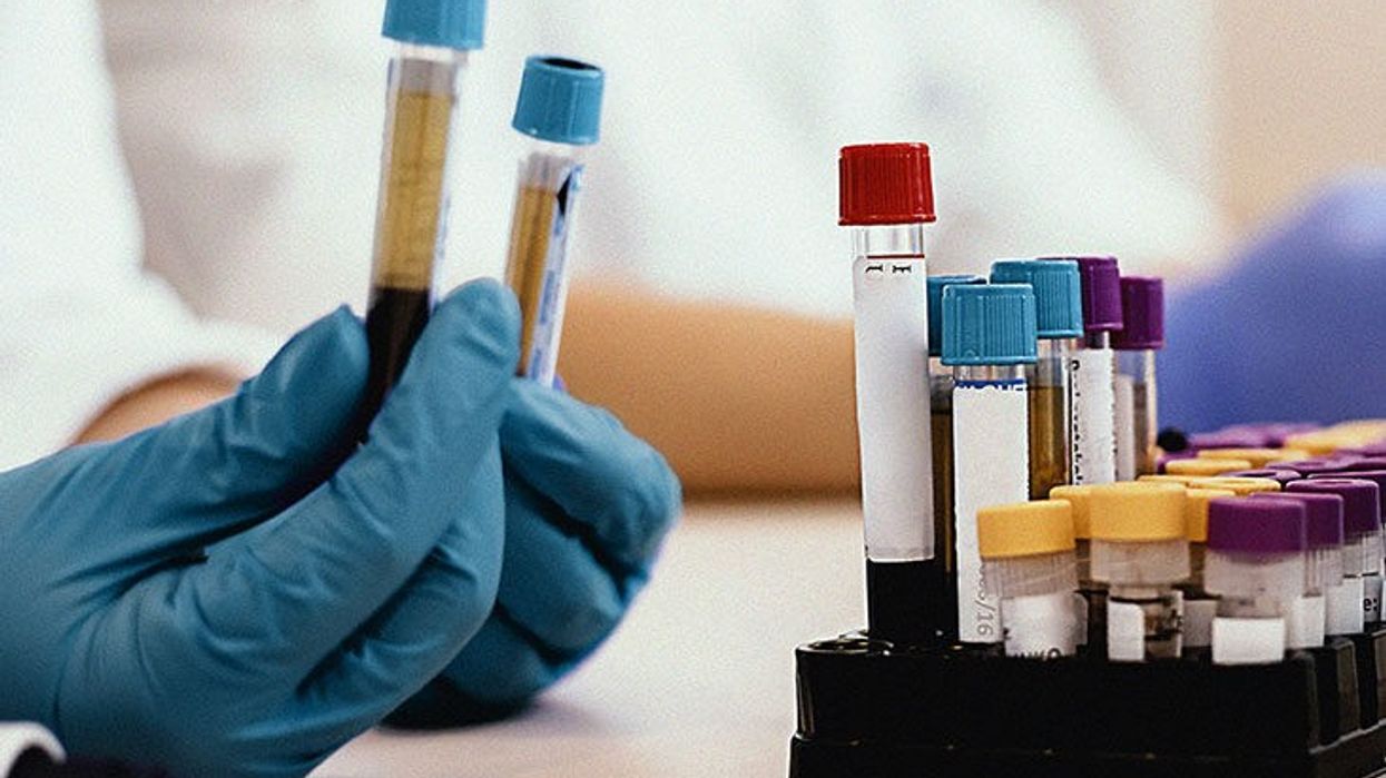 What do high, normal, or low Platelet Count Levels mean?