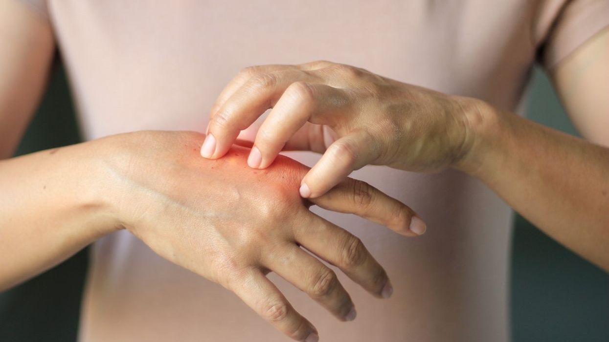 Emami acquires Dermicool brand from Reckitt