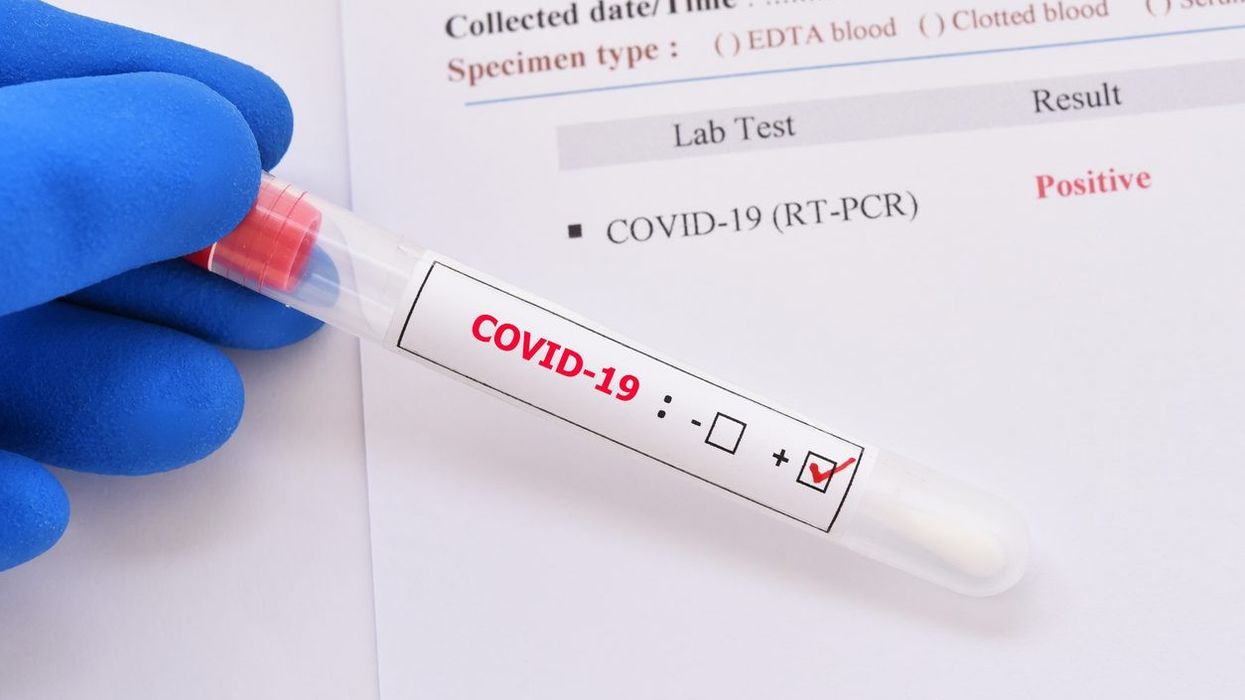 UK patient was Covid positive for record 505 days, say researchers