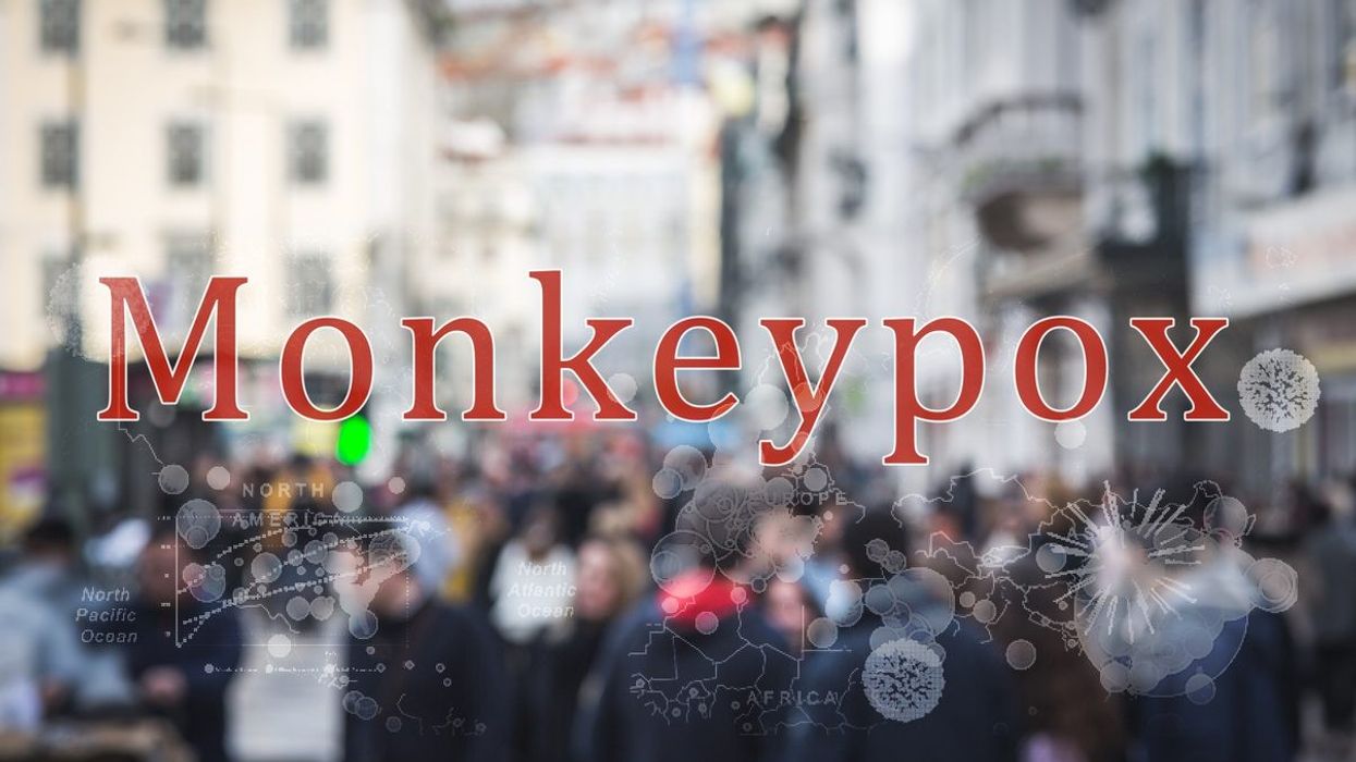 Monkeypox: People with symptoms should abstain from sex, the risk of a case infecting a pet is low, UK health advisory