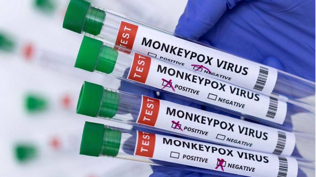 Turning crisis into opportunity: Test makers target monkeypox market as cases surge