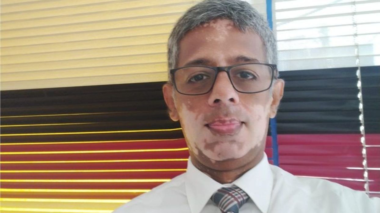 'I was desperate to update my profile pic': This Sri Lankan CEO with 'Vitiligo' has an important message about body image