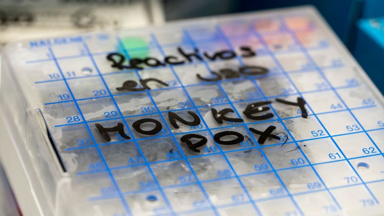 Health ALERT! Monkeypox evolving, mutating at 12 times the expected rate: Study