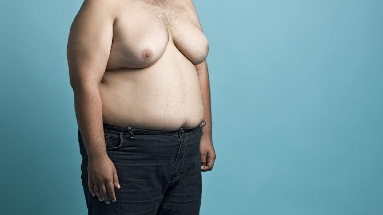 'Tens of thousands' of British men at risk of growing breasts due to rising steroid use