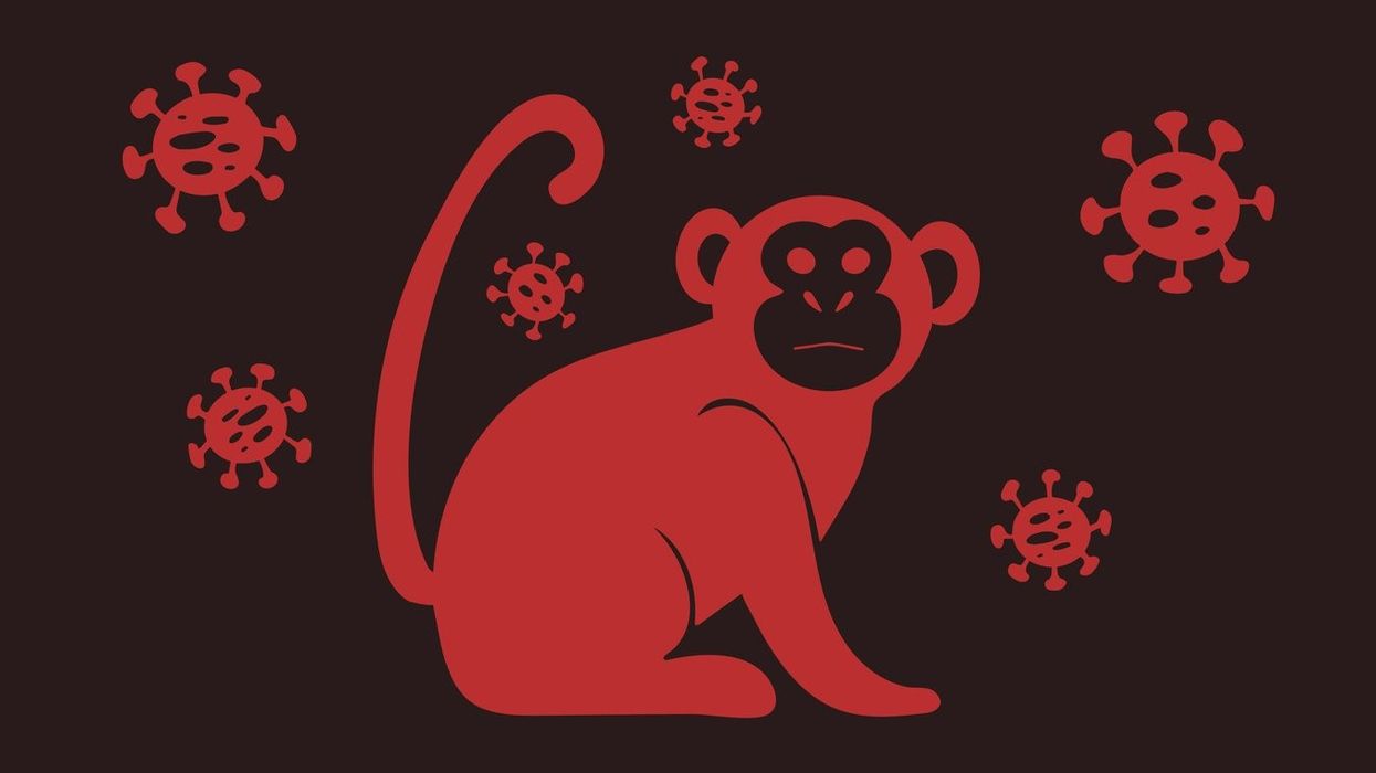 LGBT groups seek urgent government action on monkeypox spread in UK