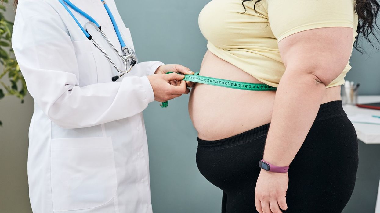Doctors and nurses 'weight shame' obese patients, research reveals