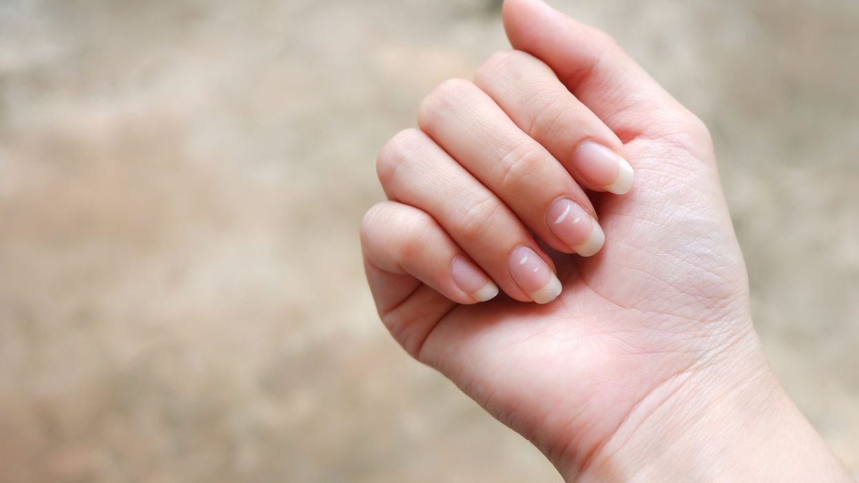 9 nail signs that point to serious health problems