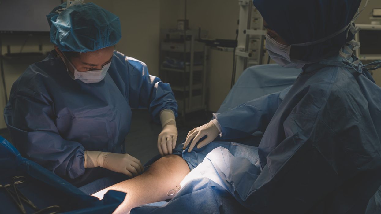 Tech workers paying at least $75,000 for surgical procedure to make them few inches taller