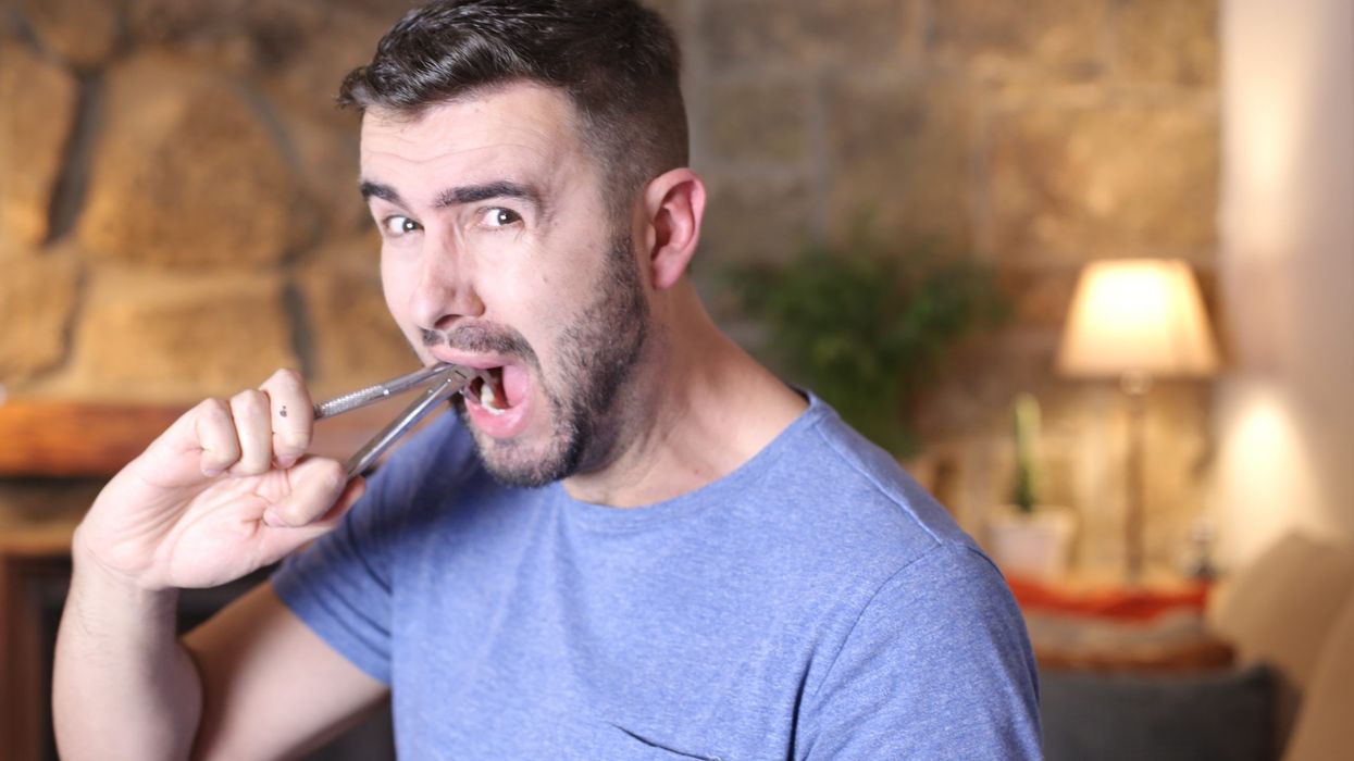 Denied dental care, UK adults turning to DIY dentistry - Survey