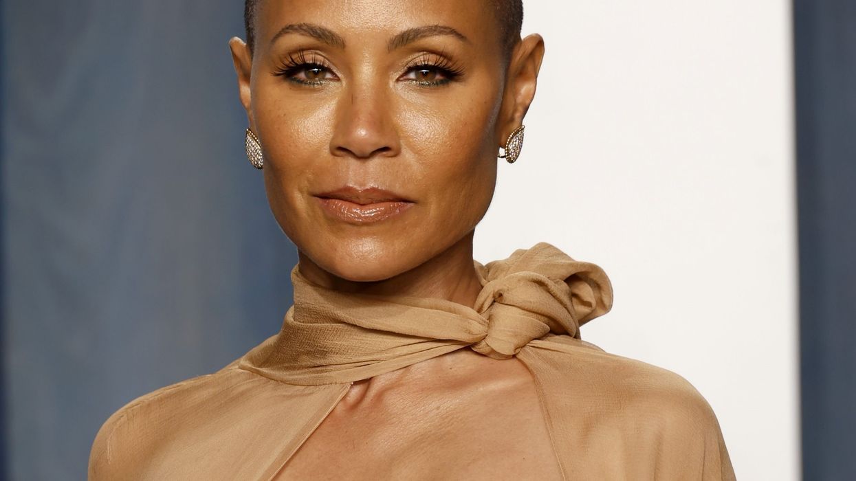 First ever drug for alopecia hair loss disorder which affects Jada Pinkett Smith and thousands of Brits to get funded by NHS