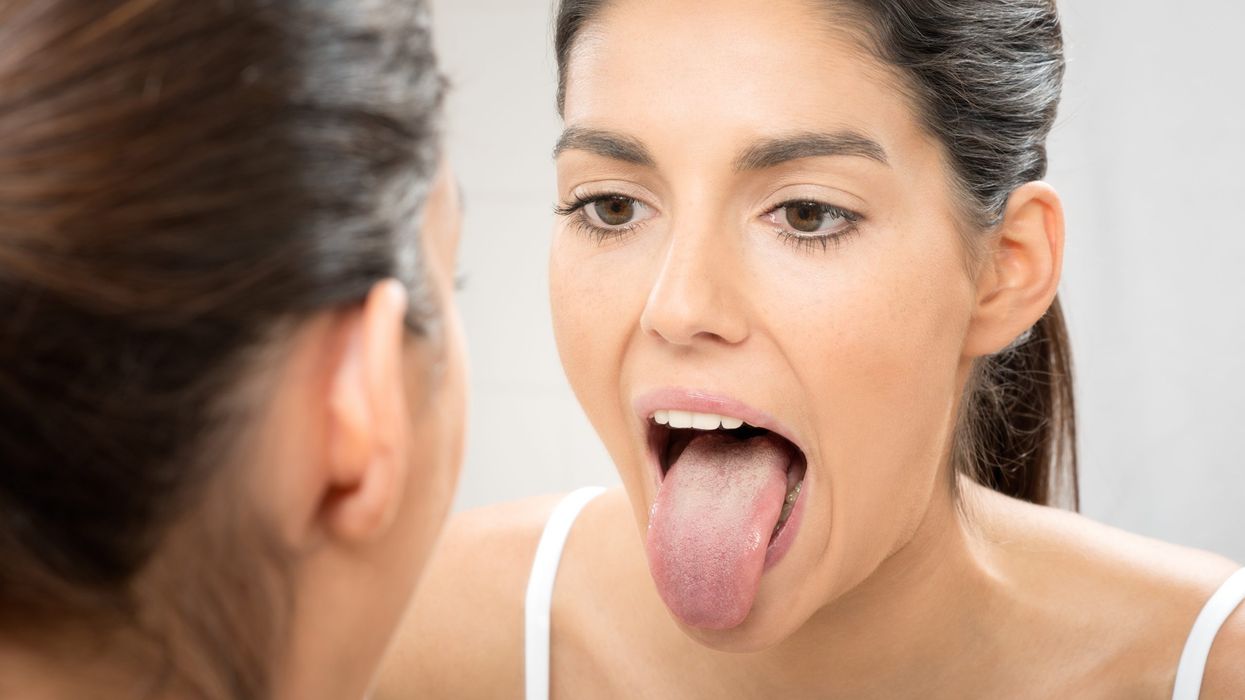 What does your tongue reveal about your health?
