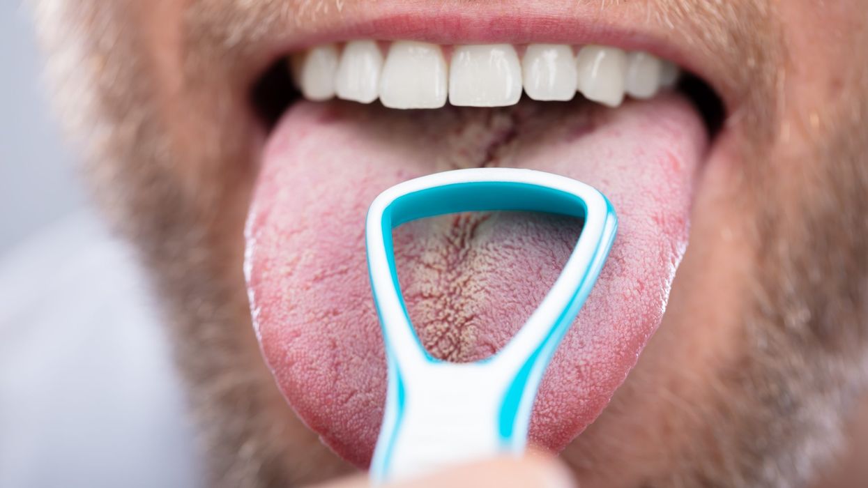 TikTok tongue scraping trend can boost oral hygiene – Experts say