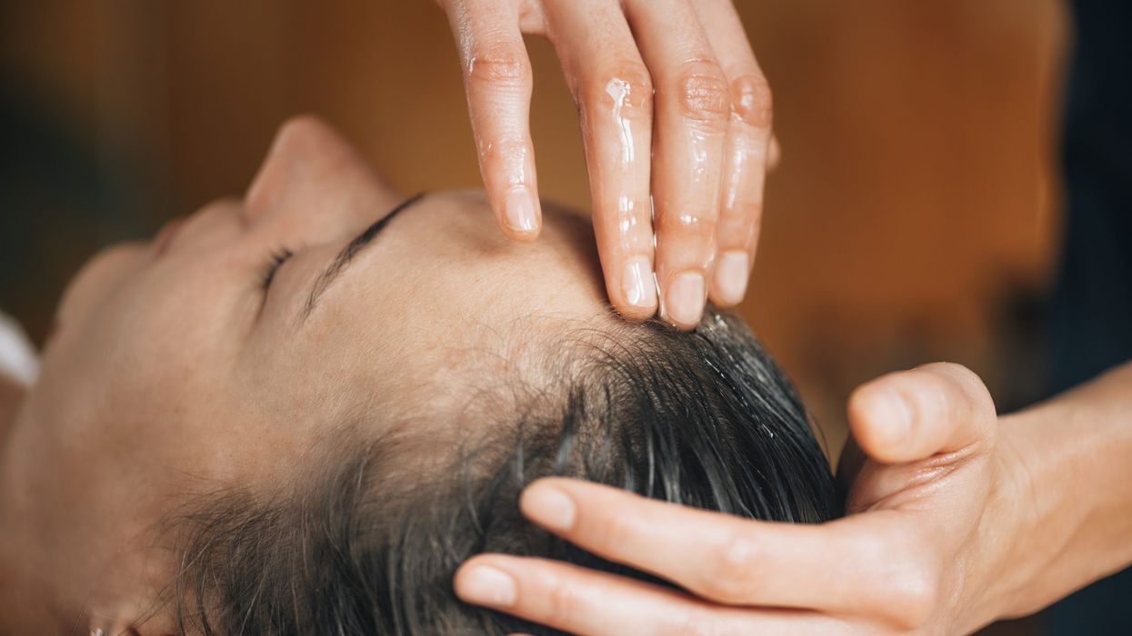 Top Ayurvedic remedies to fight hair loss