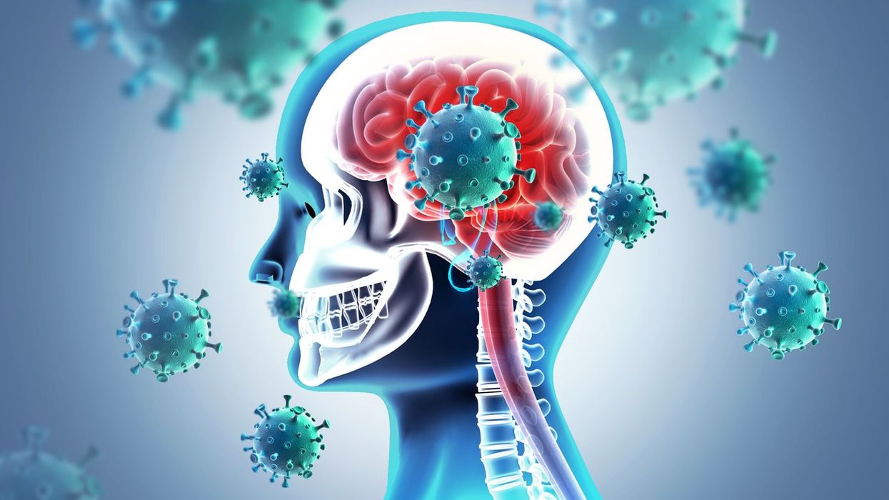 Covid pandemic altered teens' brains, study finds