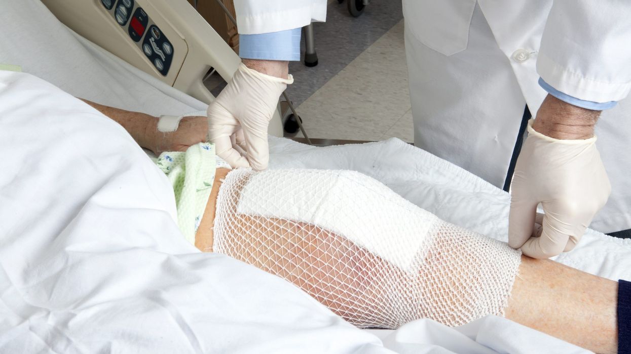 More than 10,000 people in UK given defective knee implants