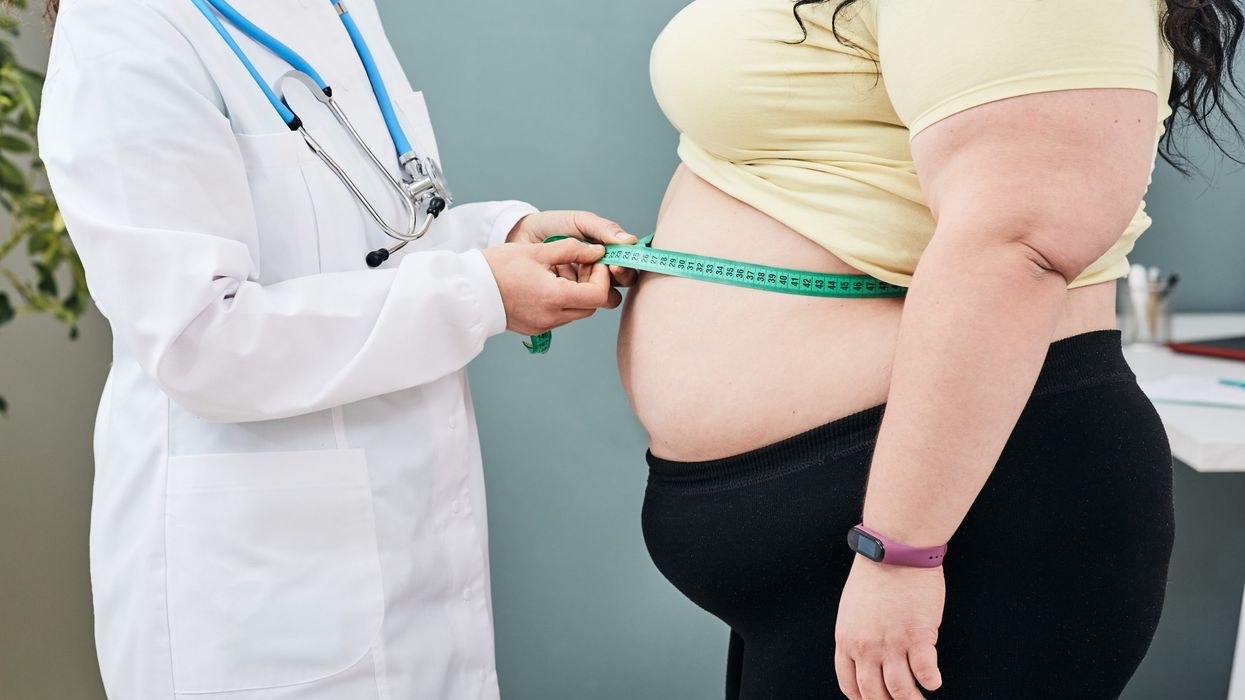 Obese patients get ineffective weight loss advice from doctors: Study