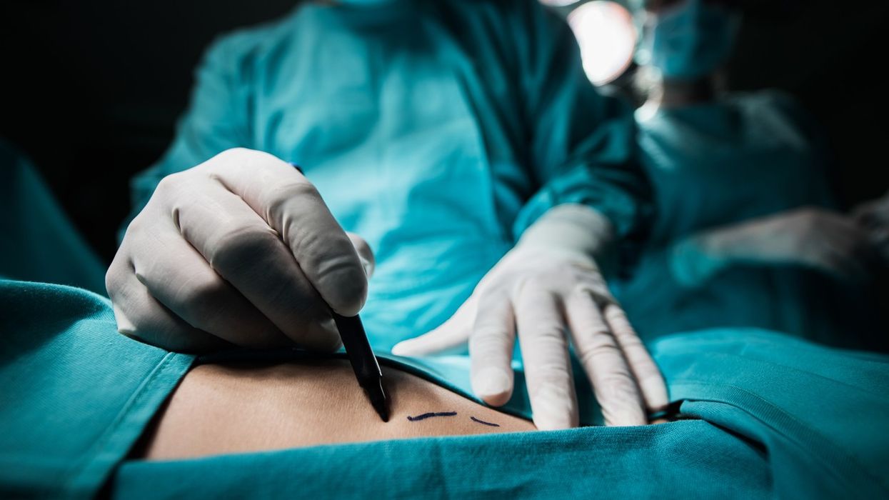 Salisbury plastic surgeon had 106 child abuse images on phone, court hears