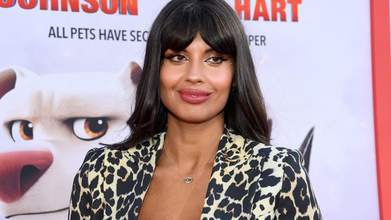 Actor Jameela Jamil suffers from Ehlers-Danlos Syndrome (EDS) – All you need to know about this rare condition