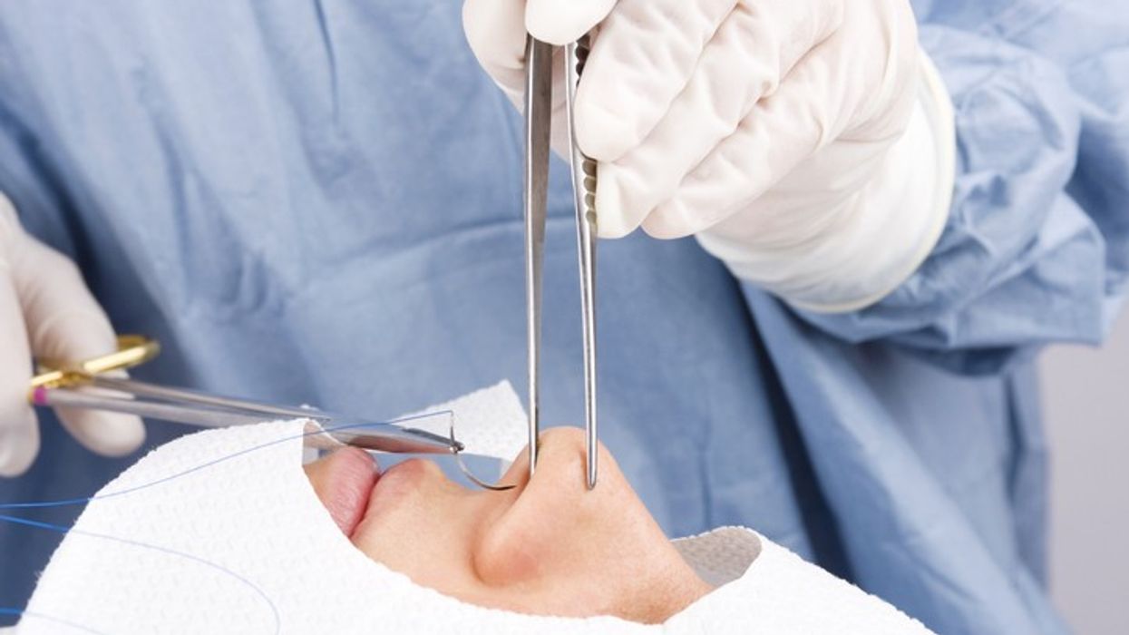 21-year-old woman tragically dies after nose job goes horribly wrong