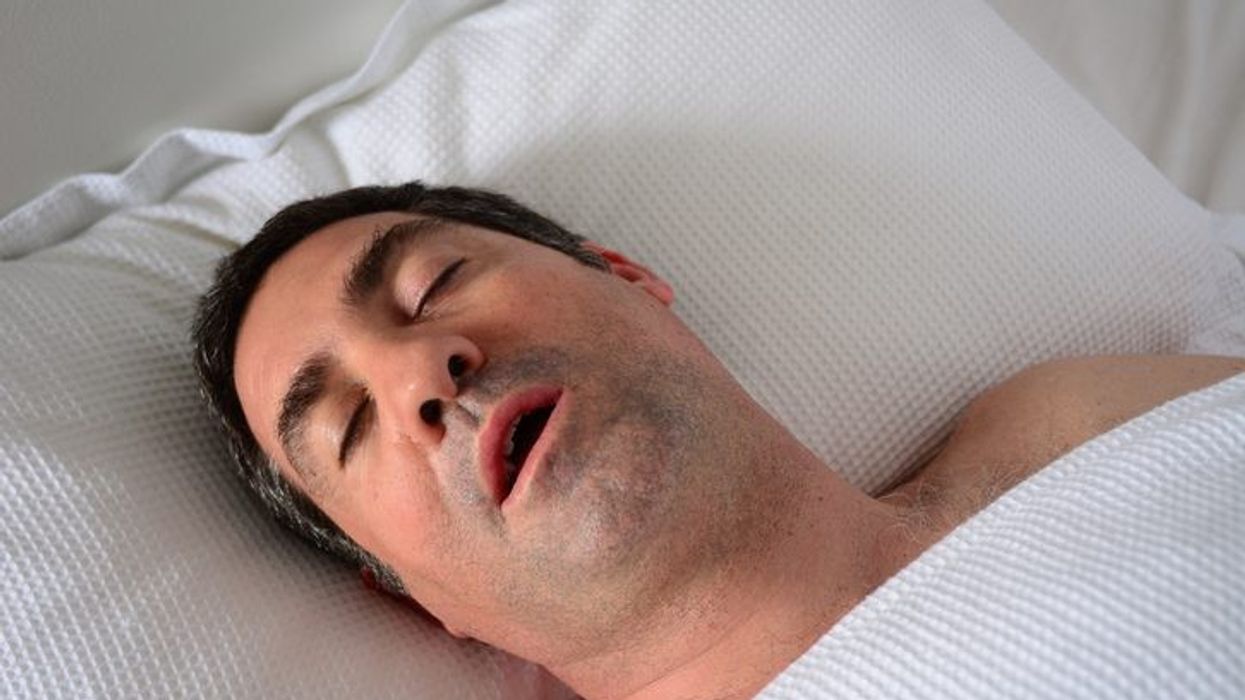 Study finds link between obstructive sleep apnea and early cognitive decline