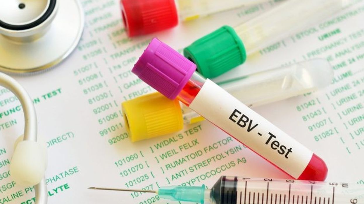 Researchers uncover trigger mechanism for onset of multiple sclerosis