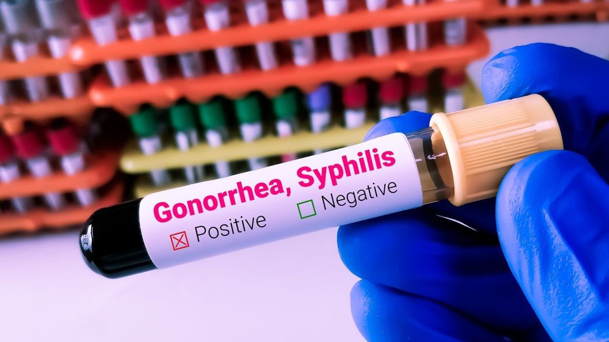 Gonorrhoea, syphilis on rise in England: Health agency