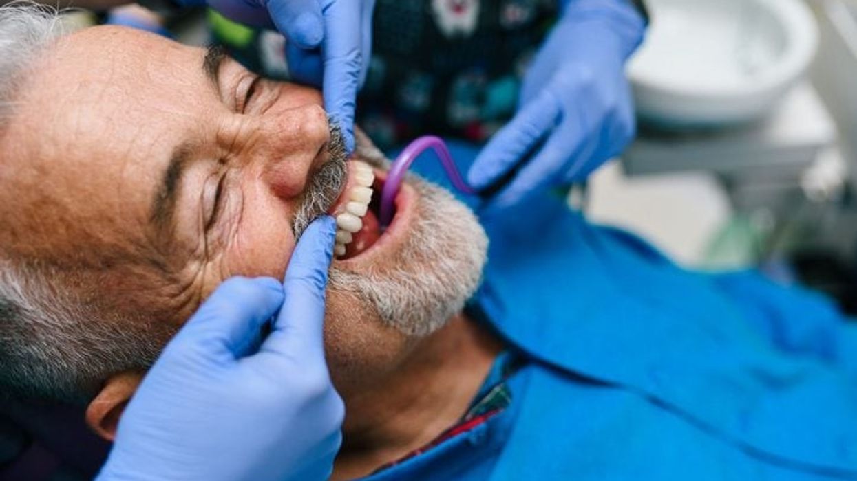 Gum disease linked to the formation of Alzheimer's plaques: Study