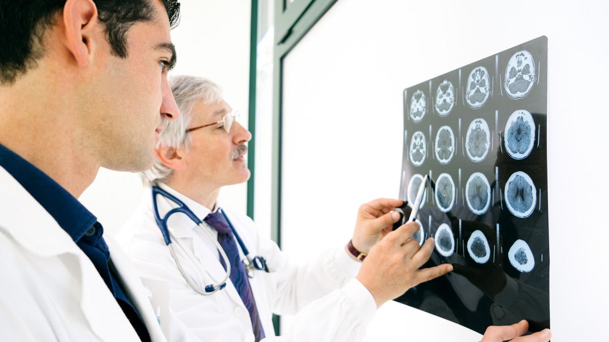 Donanemab drug shows potential in slowing Alzheimer’s progression