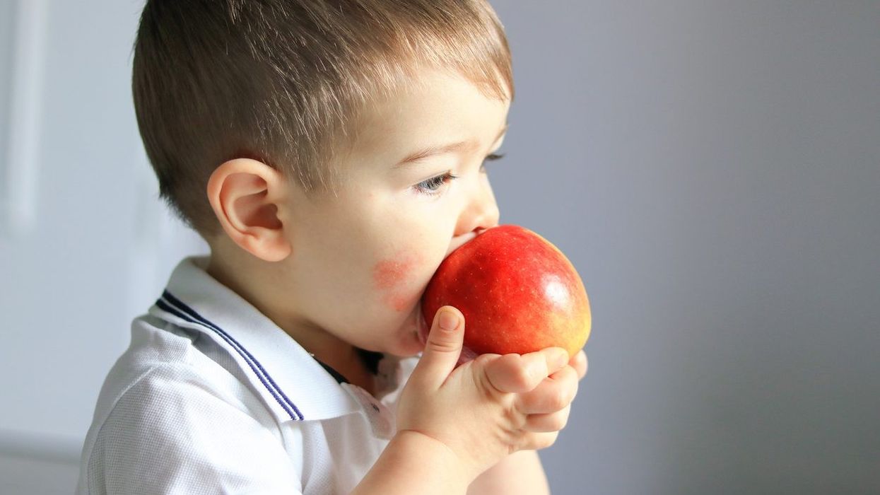 Food allergy in infancy linked to asthma, poor lung function in later childhood