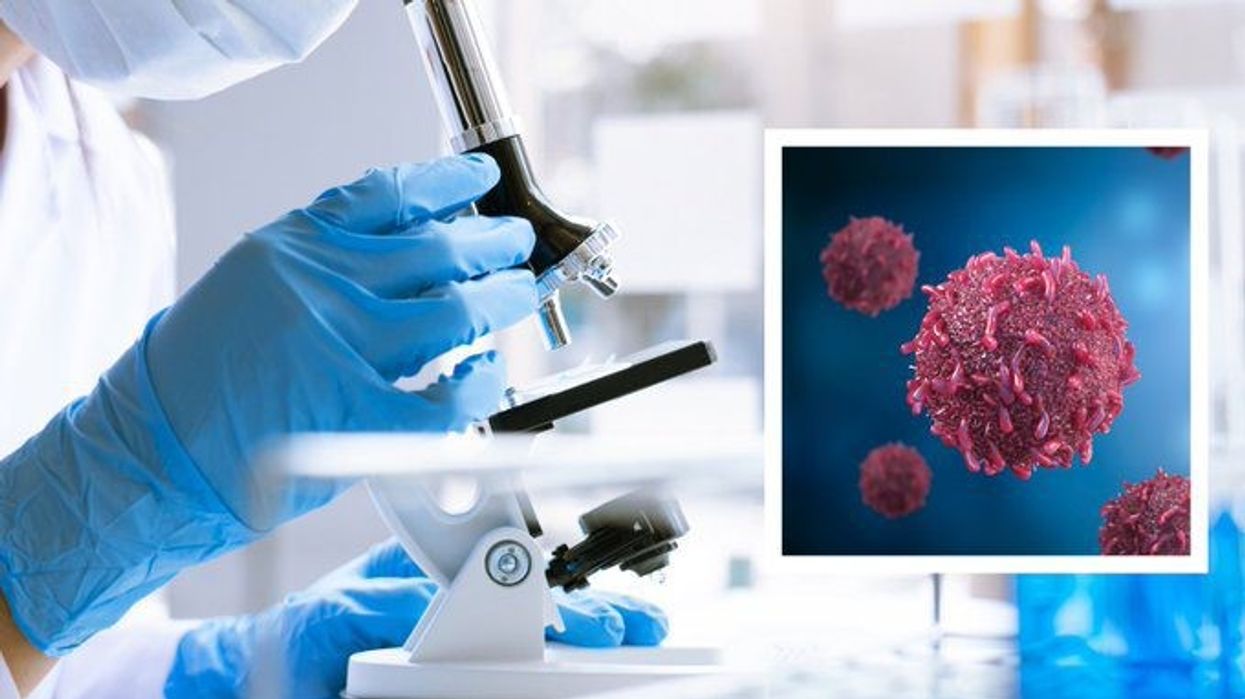 Breakthrough cancer drug: Early study reveals pill's ability to annihilate all solid tumours
