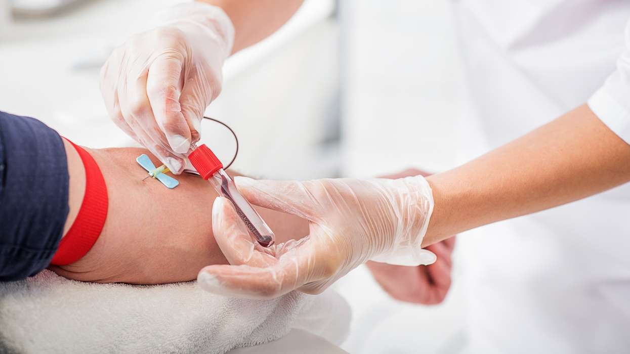 Simple blood test enhances accuracy in bipolar disorder diagnosis: Study