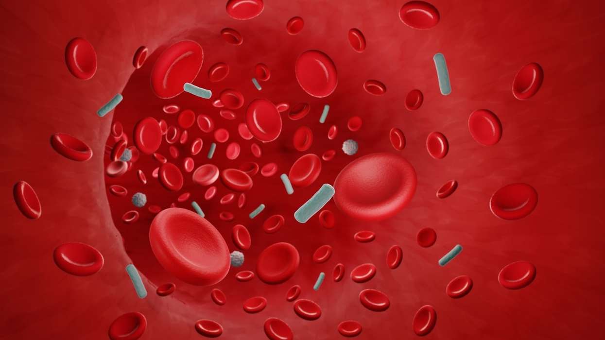 Concern over higher risk of sepsis among south Asians