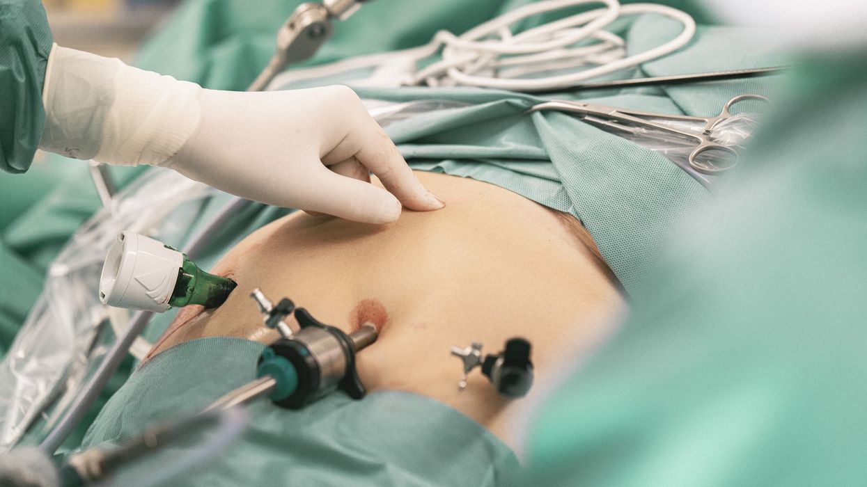 Surgeon advises patient to eat more to qualify for weight loss surgery