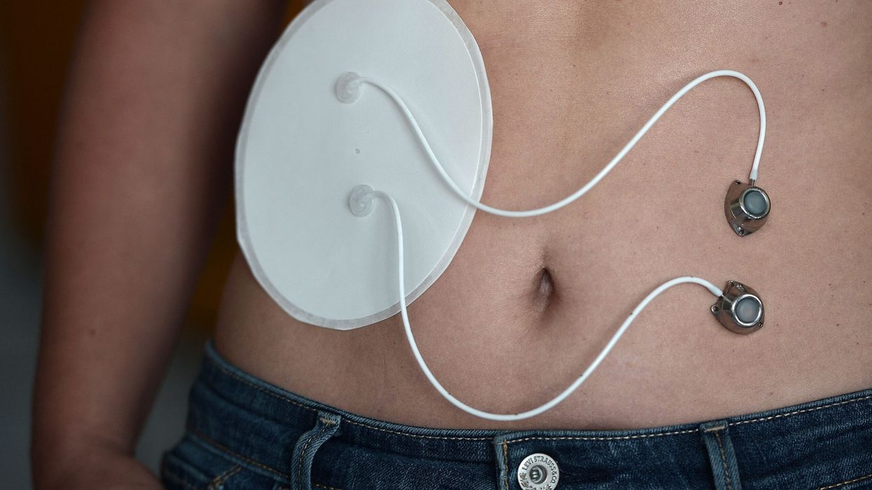 Diabetes patients in England to get artificial pancreas in a world-first