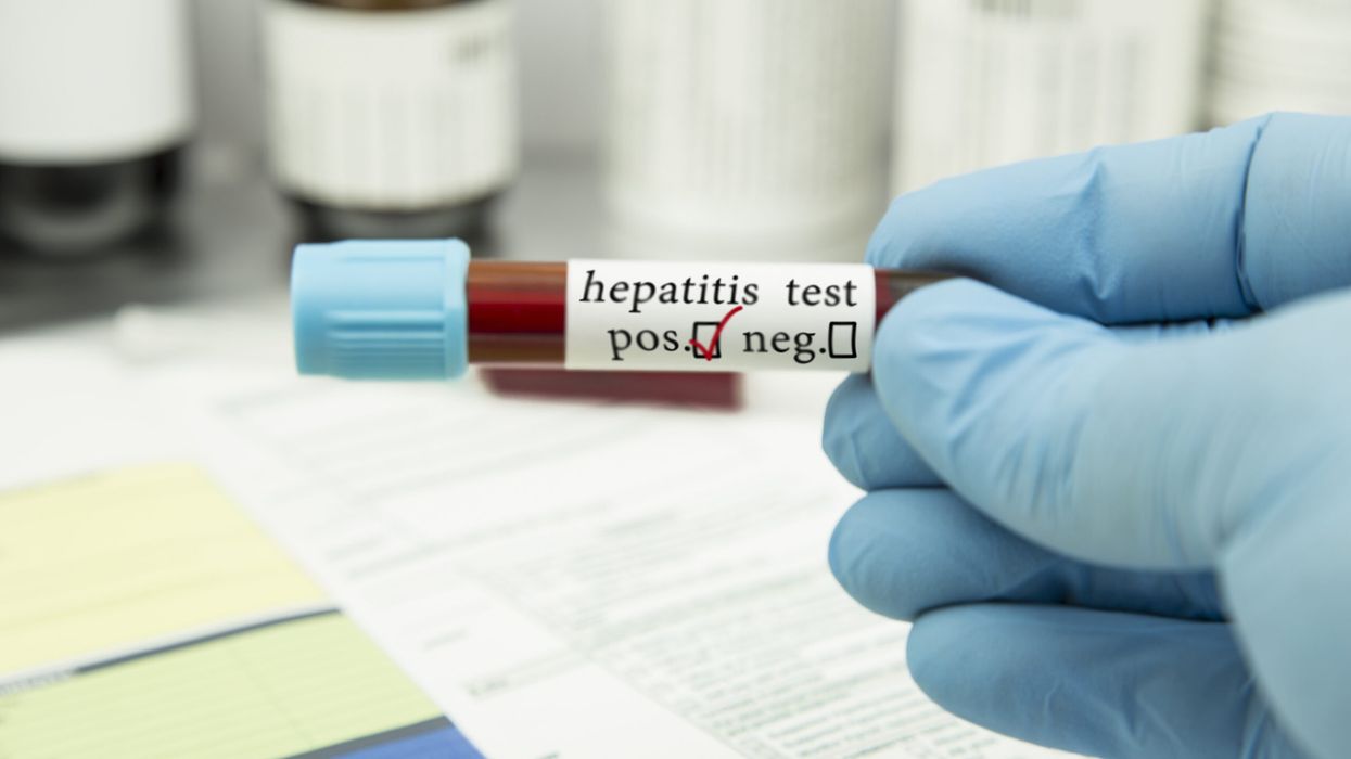 WHO raises alarm over 3,500 daily deaths from hepatitis infections