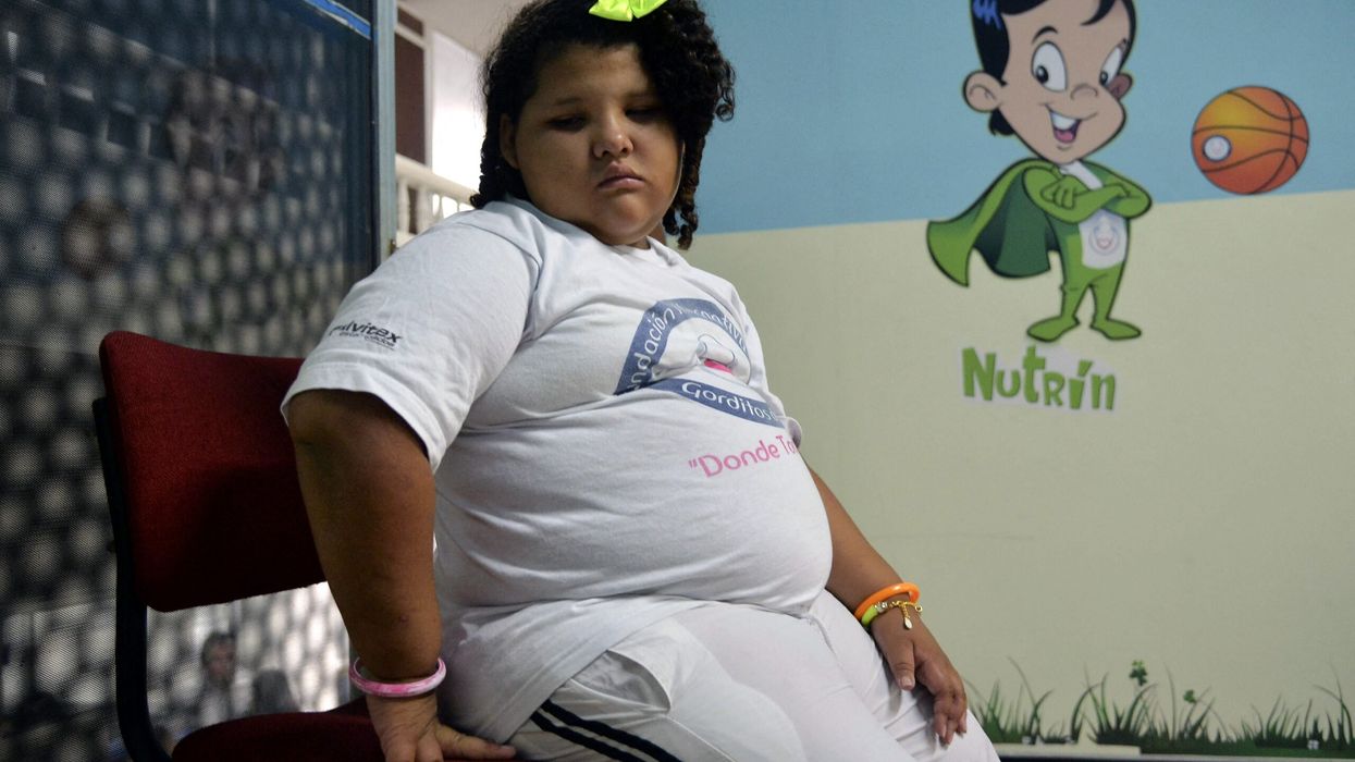 Obesity a possible contributor to early menarche in girls, study finds