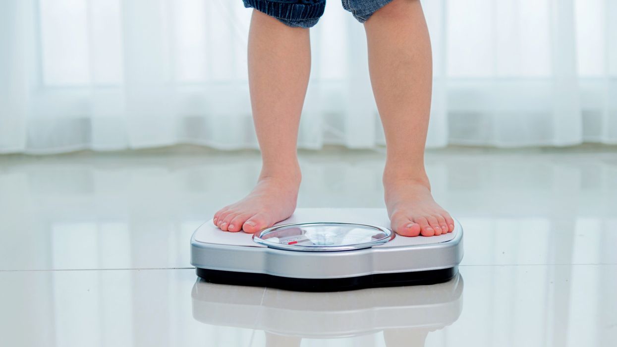 Sharp increase in child obesity in England: Report