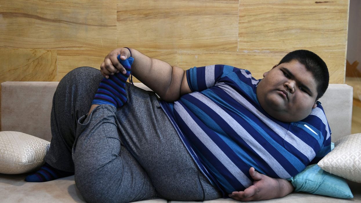 BMI alone not sufficient in diagnosing obesity: Researchers