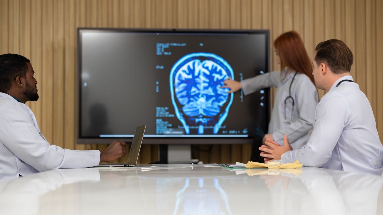 Gene deletion linked to brain discrepancies may predict psychosis risk, study finds