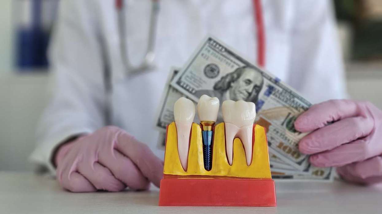 How Much Do Dental Implants Really Cost? A Patient's Guide to Understanding Pricing